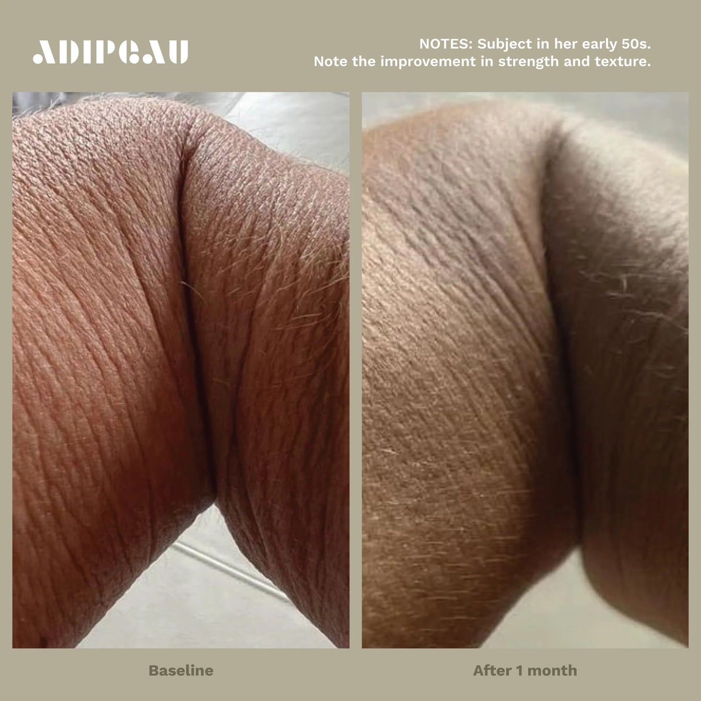 Strength Gel | Adipeau