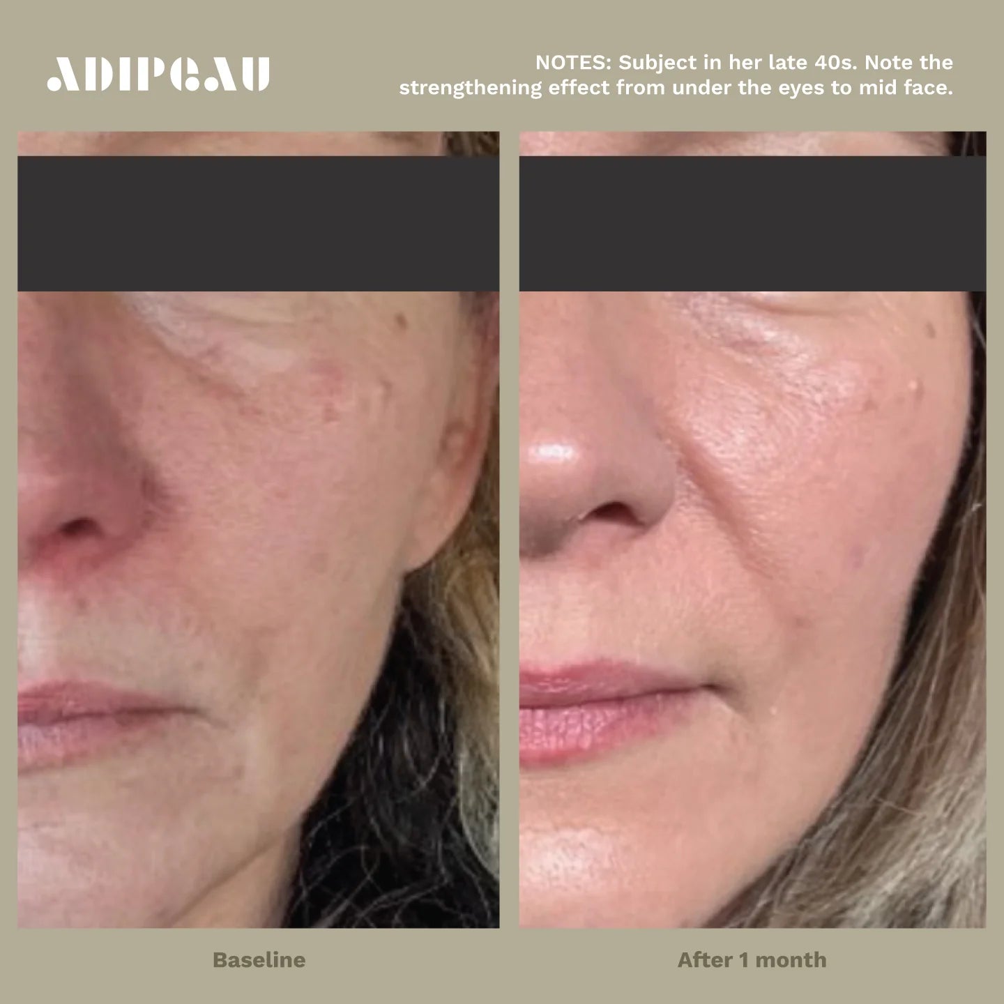 Strength Gel | Adipeau