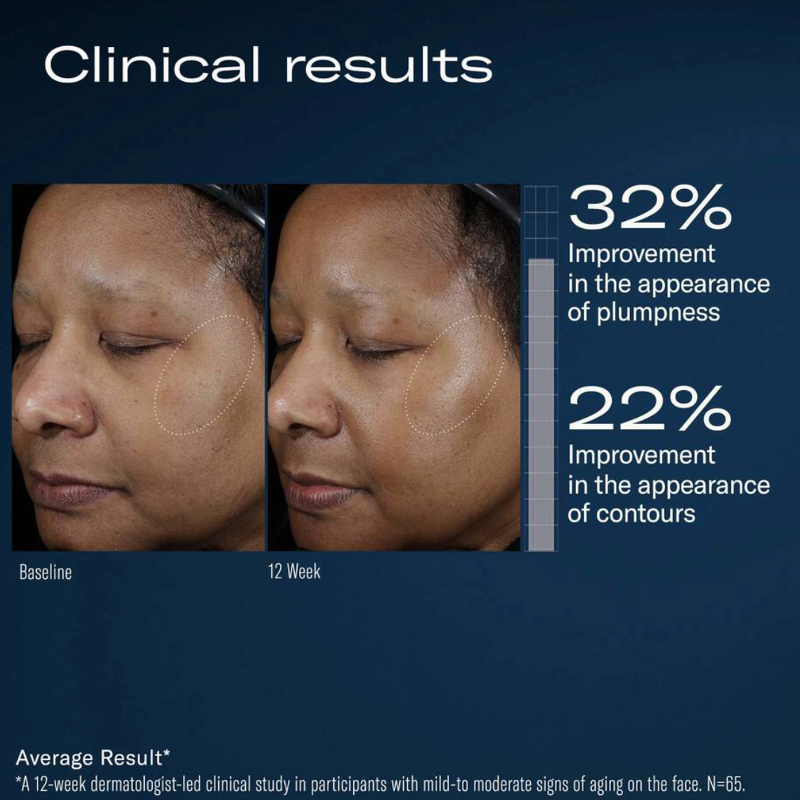 Ampra Volumizing Macro HA Serum | skinbetter science